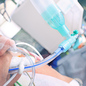 Sound absorbing solutions for intake and exhaust plenums in medical equipment